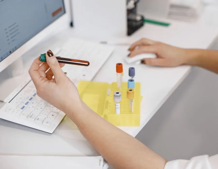 Muestras de sangre en el laboratorio de análisis clínicos